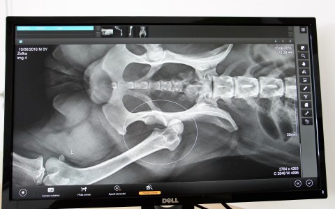 Digitální rentgen s anatomickým programem